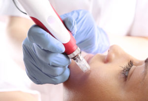 Art Beaute medizinisch kosmetische Ästhetik Bern Kosmetik Hautbehandlung Fusspflege Permanent Make-up Mesotherapie Microneedling