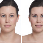Biolux LichttherapieArt Beaute medizinisch kosmetische Ästhetik Bern Kosmetik Hautbehandlung Fusspflege Permanent Make-up