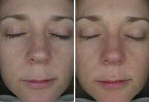 Art Beaute medizinisch kosmetische Ästhetik Bern Kosmetik Hautbehandlung Fusspflege Permanent Make-up LPG Endermologie