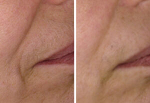 Art Beaute medizinisch kosmetische Ästhetik Bern Kosmetik Hautbehandlung Fusspflege Permanent Make-up LPG Endermologie