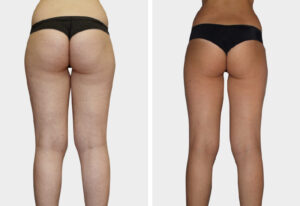 Art Beaute medizinisch kosmetische Ästhetik Bern Kosmetik Hautbehandlung Fusspflege Permanent Make-up LPG Endermologie