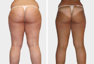 Art Beaute medizinisch kosmetische Ästhetik Bern Kosmetik Hautbehandlung Fusspflege Permanent Make-up LPG Endermologie