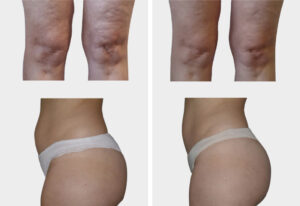 Art Beaute medizinisch kosmetische Ästhetik Bern Kosmetik Hautbehandlung Fusspflege Permanent Make-up LPG Endermologie